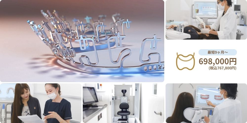 ブラーバ矯正の費用と期間│DDデンタルクリニックの症例