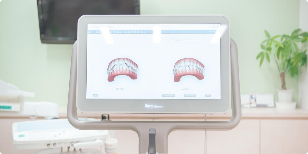 コレクトデンタルクリニック札幌の特徴