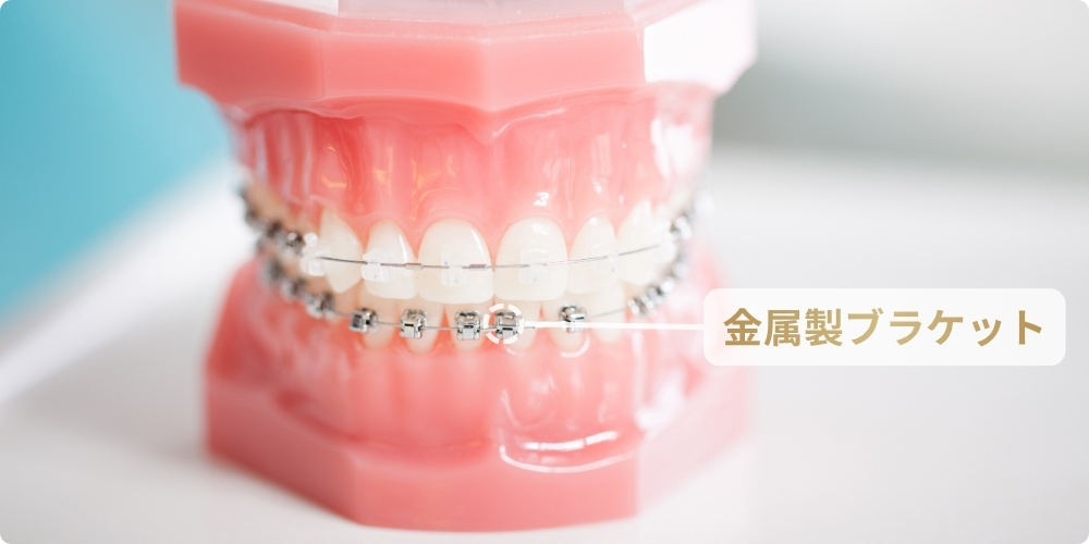 金属製ブラケット