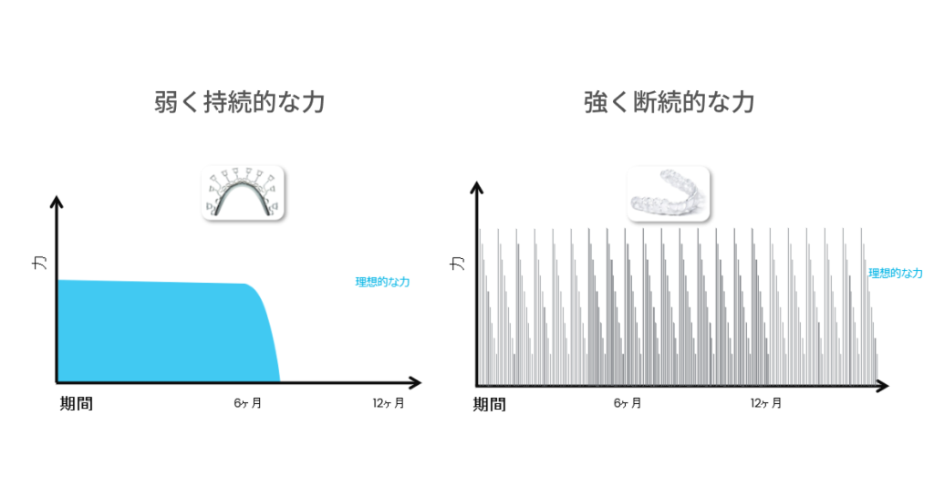 ブラーバ矯正は弱く継続的な力をかけるから負担が少ない