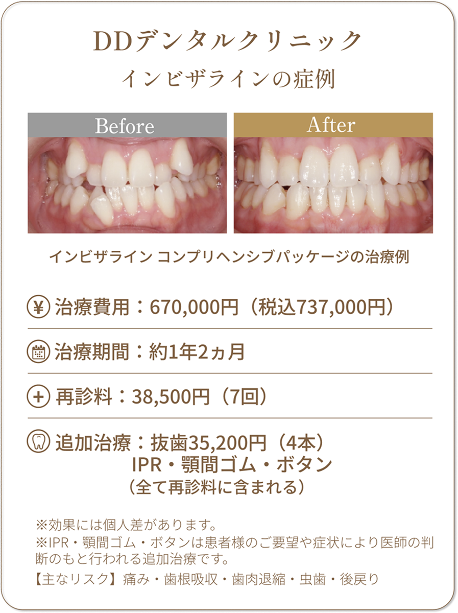 DDデンタルクリニック インビザラインの症例