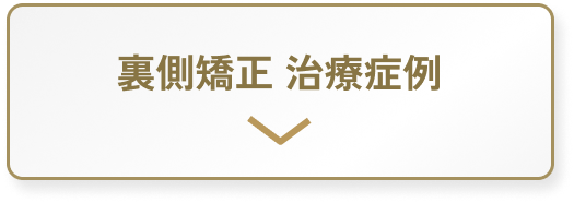 裏側矯正 治療症例