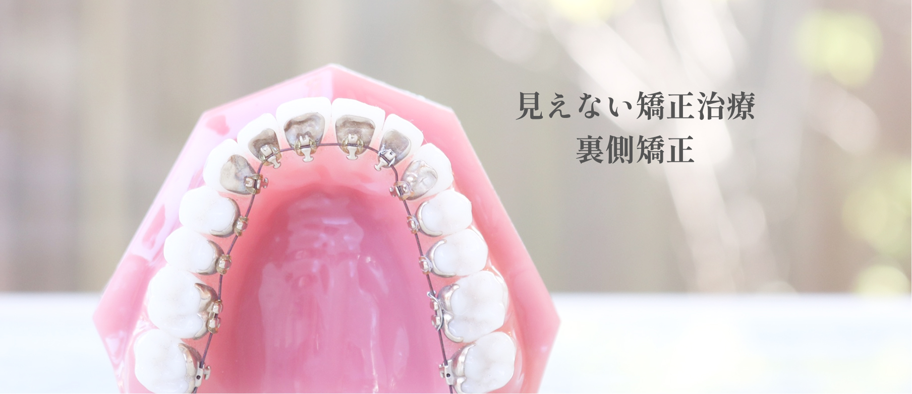 見えない矯正治療裏側矯正