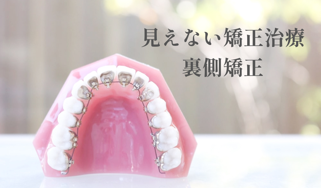 見えない矯正治療裏側矯正