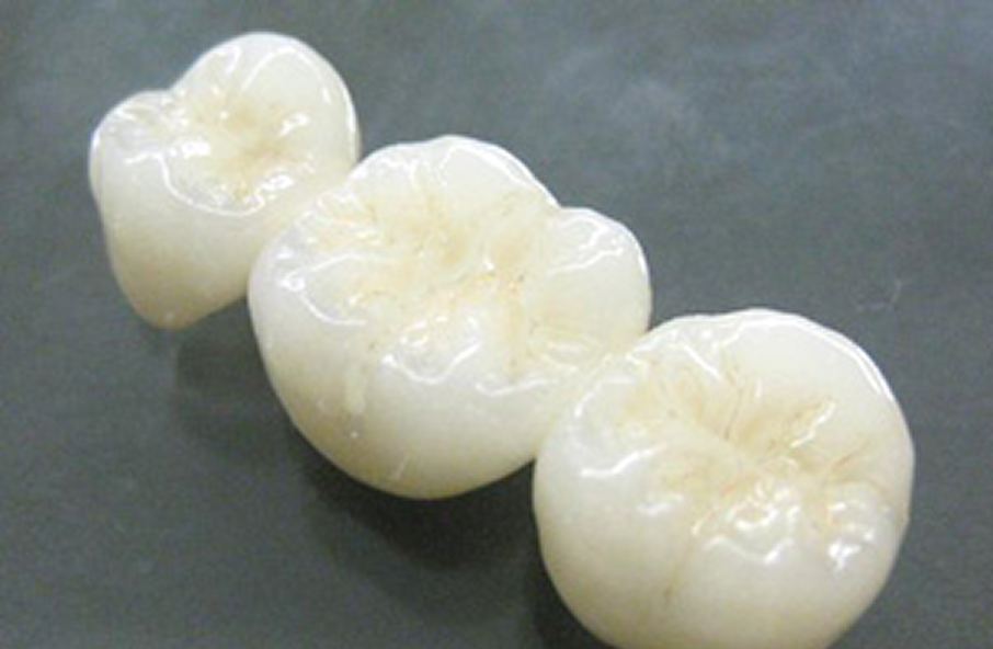 ジルコニア（セラミック）治療