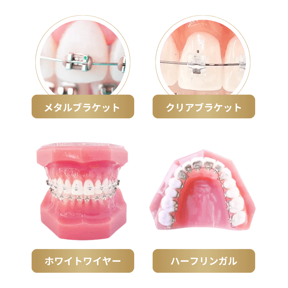 比較的目立ちにくいクリアブラケットを採用