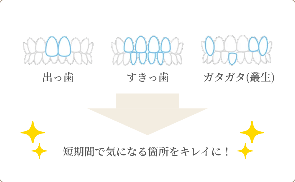 キレイラインは奥歯を大きく動かさず、前歯のお悩みの解決を目指す矯正方法